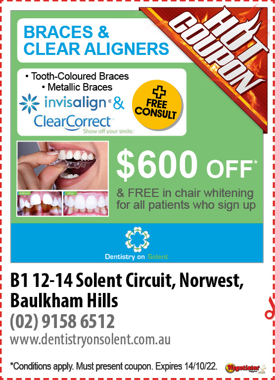 Coupon Banner