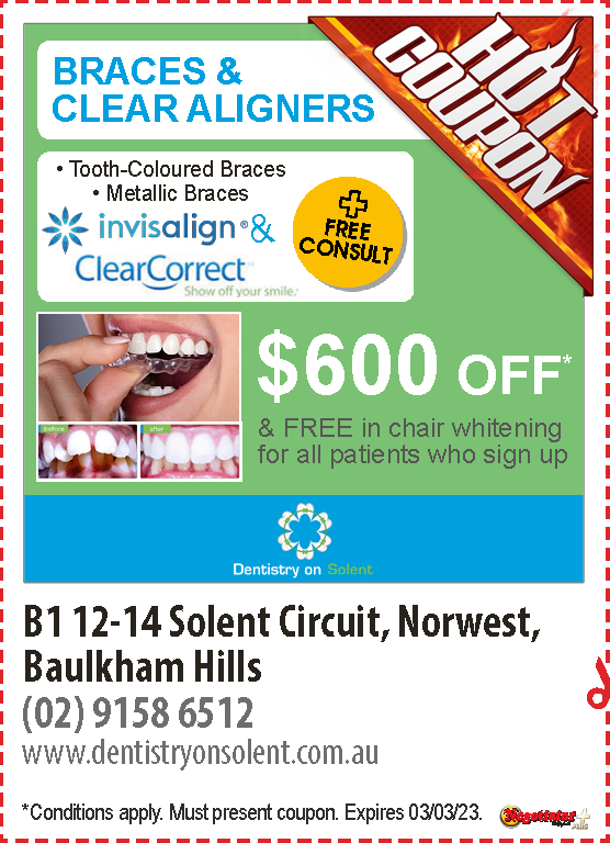 Coupon Banner