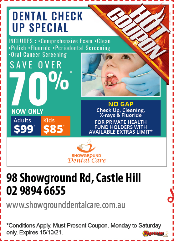 Coupon Banner