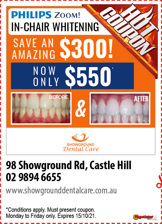 Coupon Banner